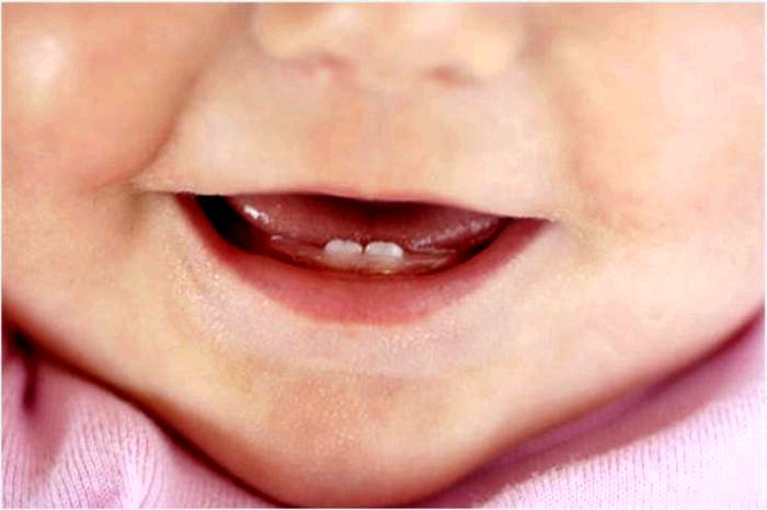 У ребенка лезут первые зубы, как лучше поступить